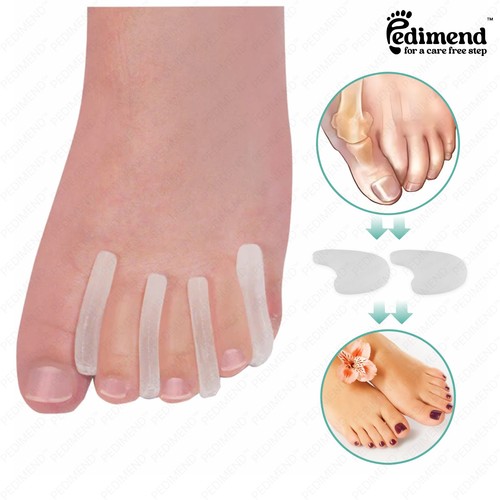 Pedimend silicone toe - pedimend™,