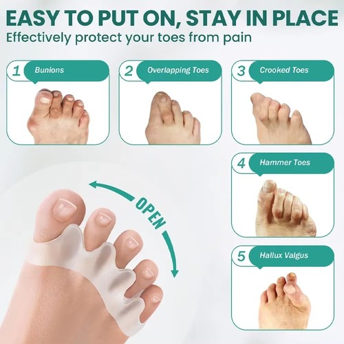 Bunion correction hammer toe - bunion,