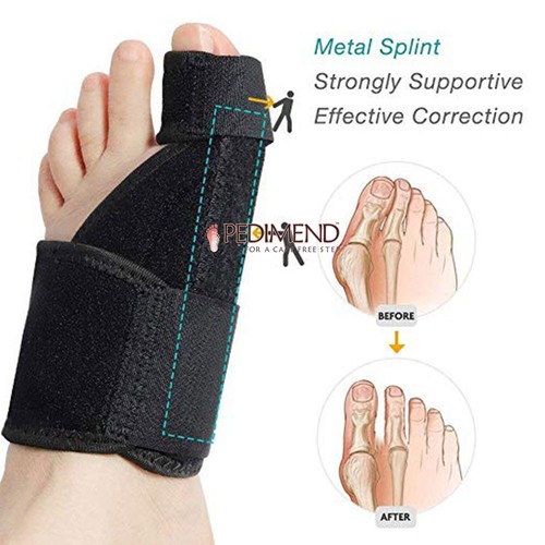 Pedimend orthopedic bunion - orthopedic,