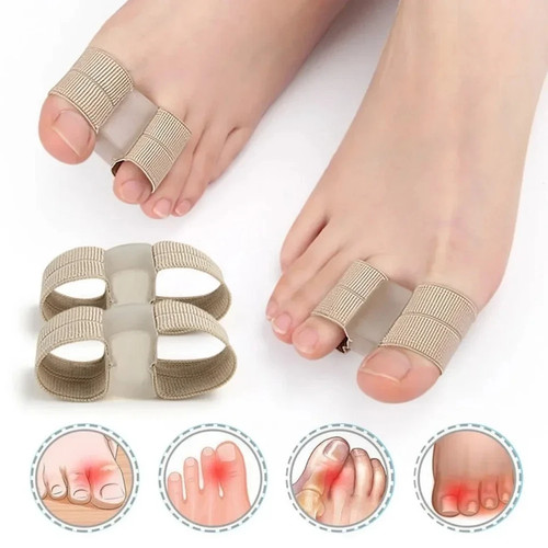 Toe separators correct - to,