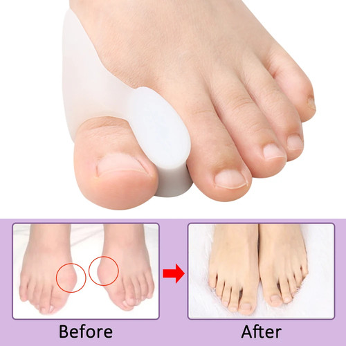 8pcs gel big toe separator - 2,